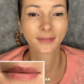 Preparation tips for a successful lip tattooing in Woodlands, ensuring optimal results and smooth healing.